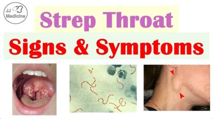 Can a child under 3 get strep throat?