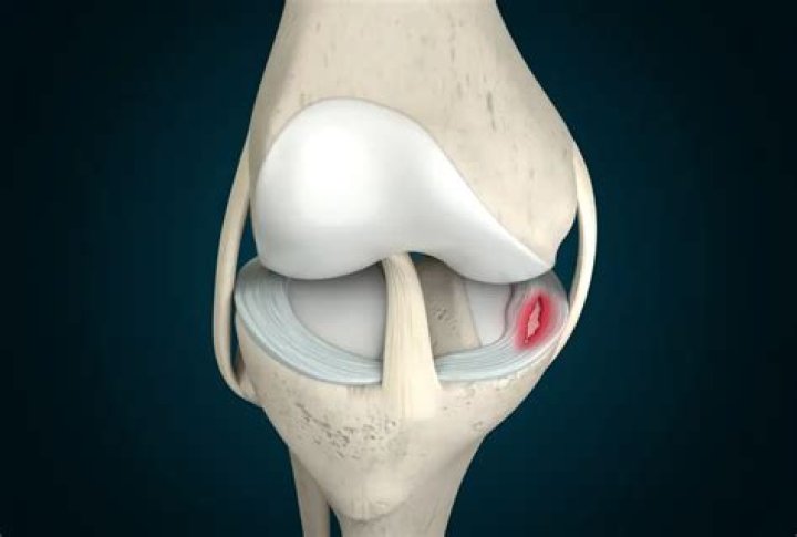 Can a degenerative meniscus tear heal?