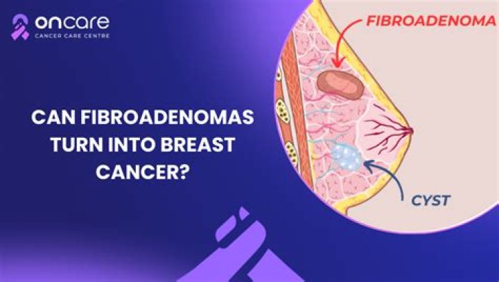 Can fibroadenomas turn into cancer?