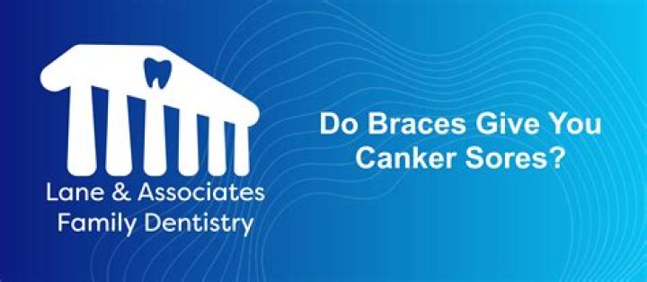 Can nuts give you canker sores?