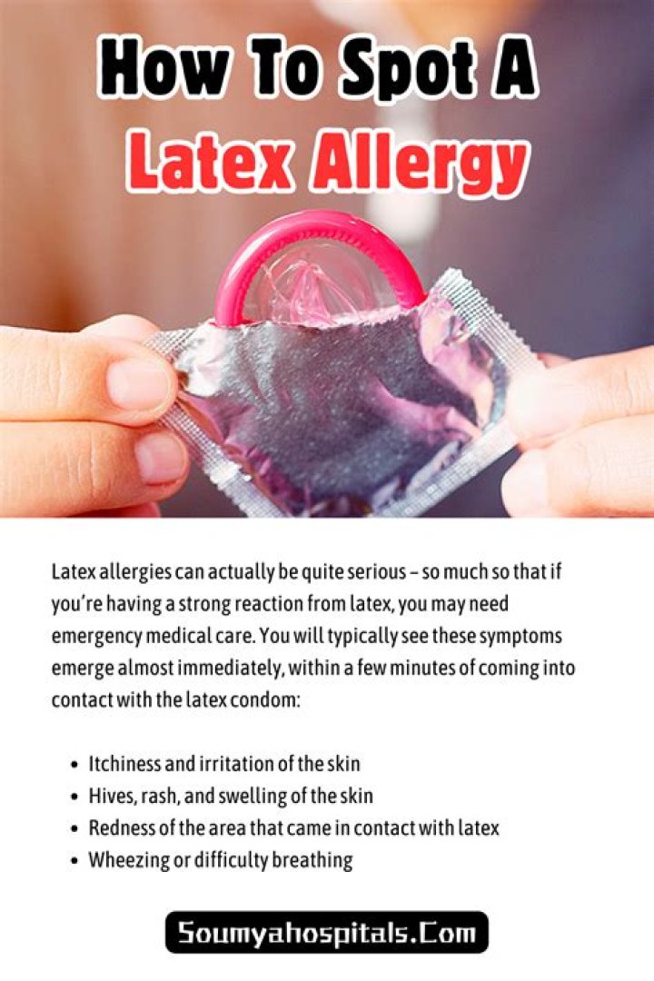 Can you be allergic to latex tape?