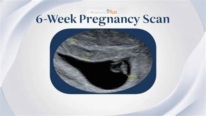 Can you see anything on an ultrasound at 8 weeks?