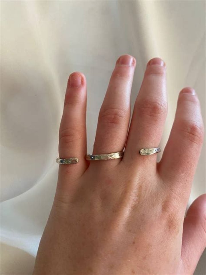 Do silver ring splints work?
