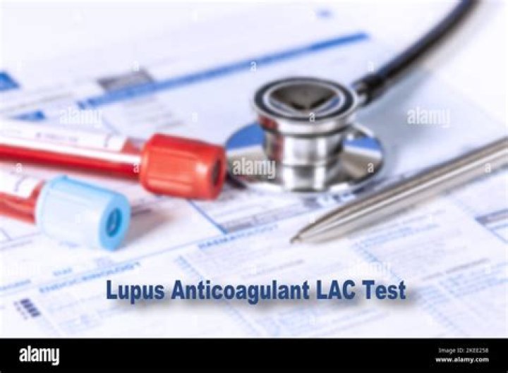 Does a positive lupus anticoagulant test mean I have lupus?