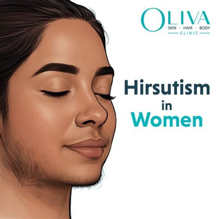 Does Diane-35 help with hirsutism?