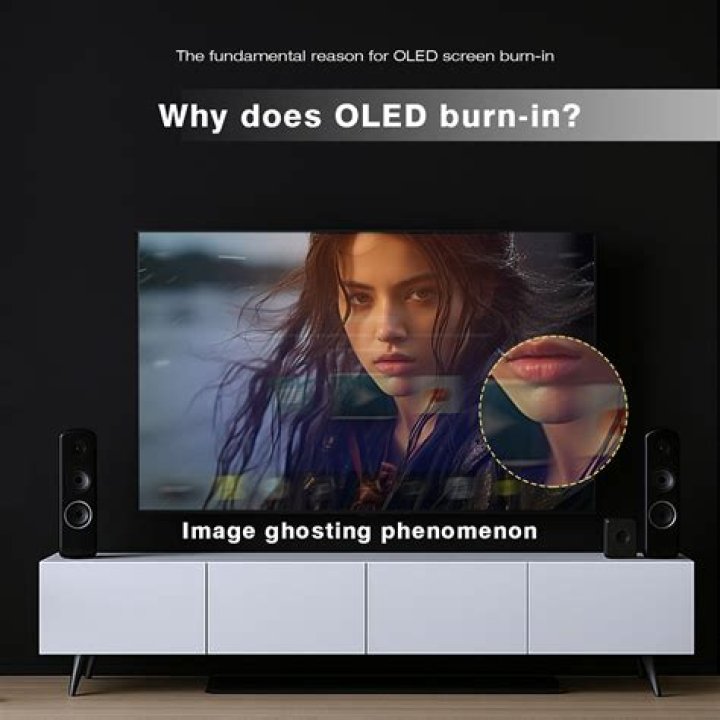 Does LG cover OLED burn-in?