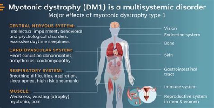 Does myotonic dystrophy affect the liver?