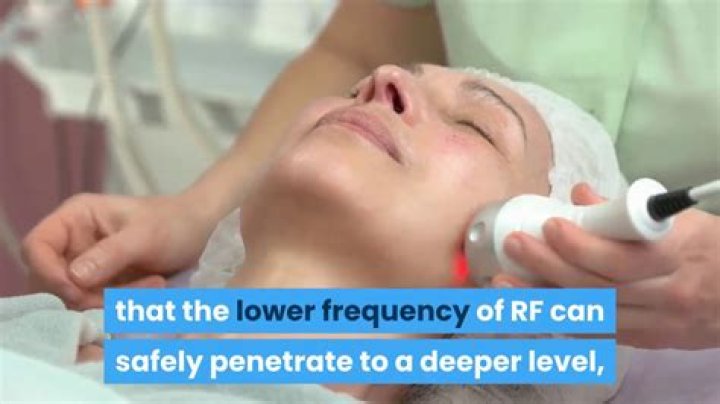 Does radio frequency skin tightening really work?
