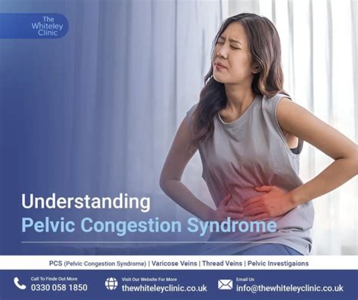 Does weight affect pelvic congestion syndrome?