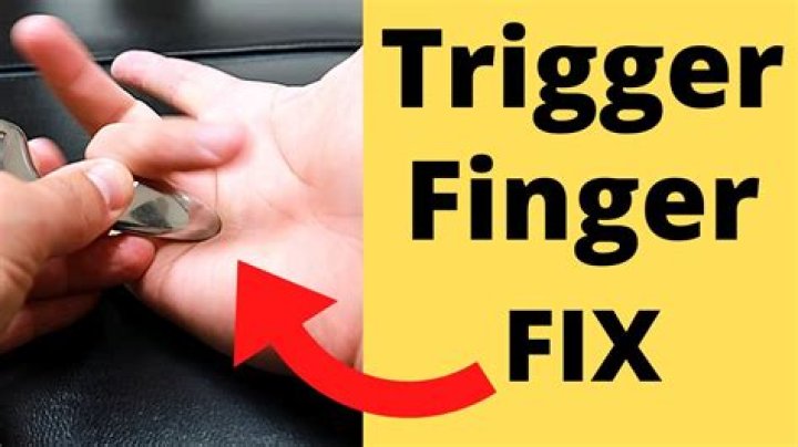 How can I fix my trigger finger myself?