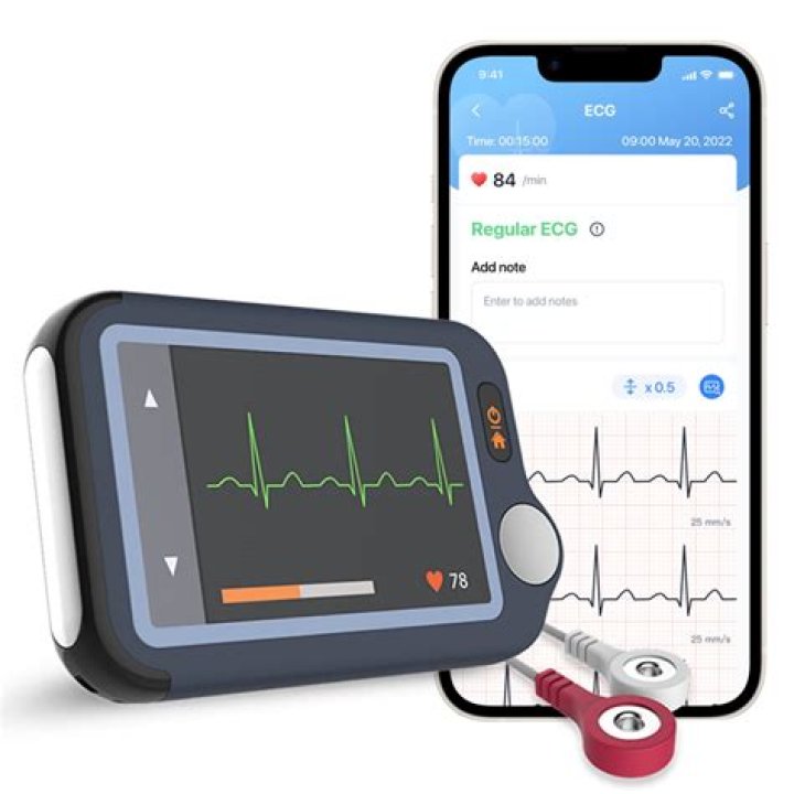 How can I monitor my arrhythmia at home?