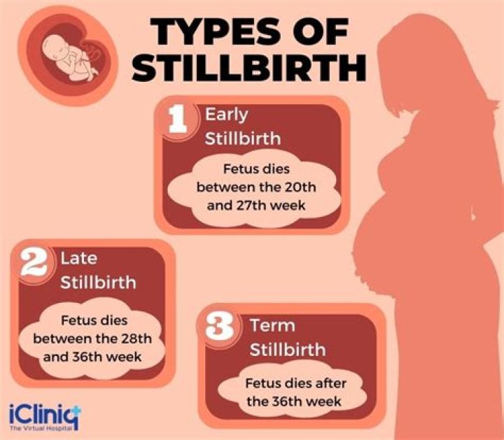 How common is a stillbirth UK?