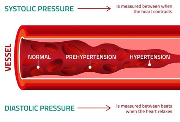 How do I get my diastolic blood pressure down