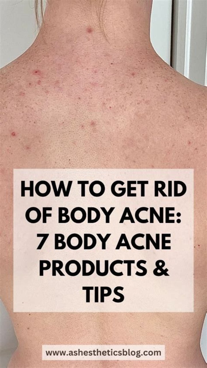 How do you get rid of body acne fast?