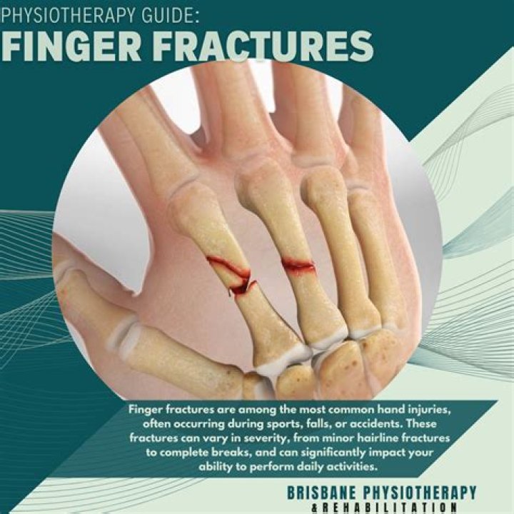 How do you know if your arm is fractured or broken?