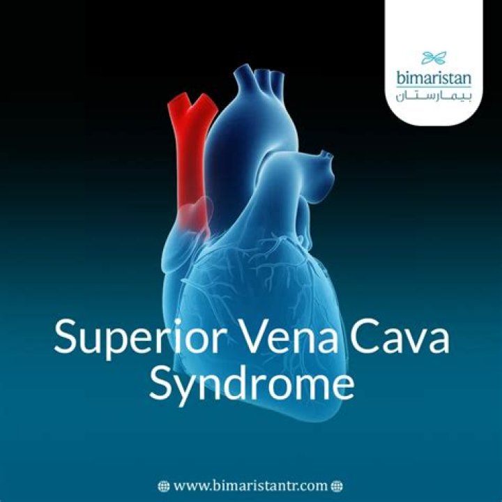 How do you manage superior vena cava syndrome?
