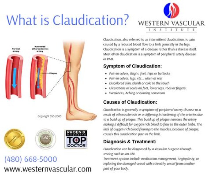 How do you test for vascular claudication