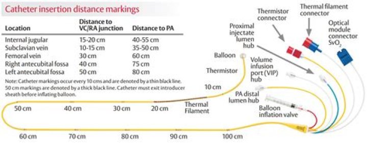 How does catheter measure pressure?