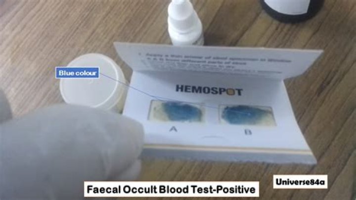 How is a Hemoccult test performed