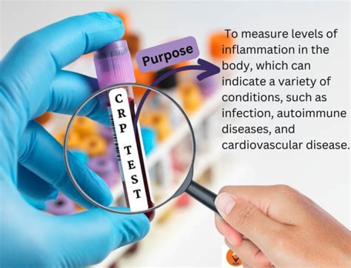 How long is a CRP sample good for?
