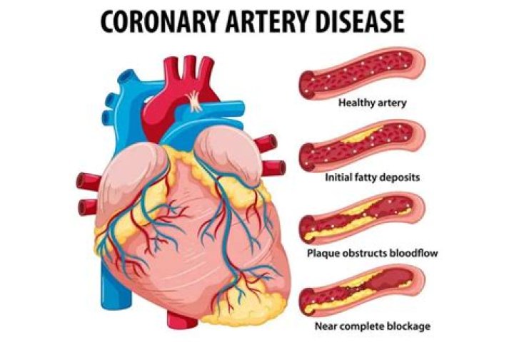 How much coronary arterial flow occurs during diastole?
