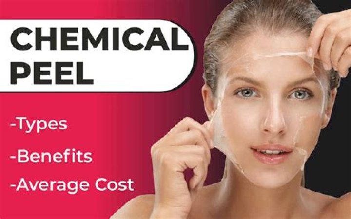 How much does a Jessner Peel cost?