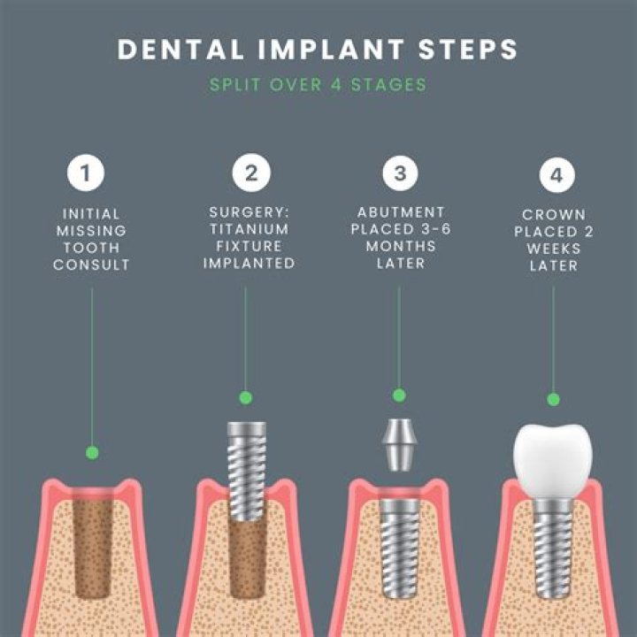Is it normal for my implant to hurt after a year?