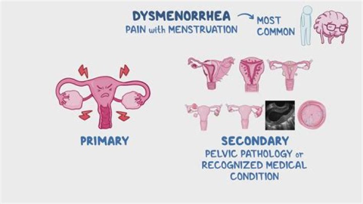 Is menorrhagia genetic