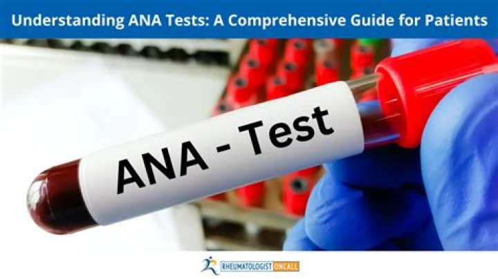 Should I be worried about a positive ANA test?