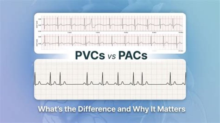 What are PVCs used for?