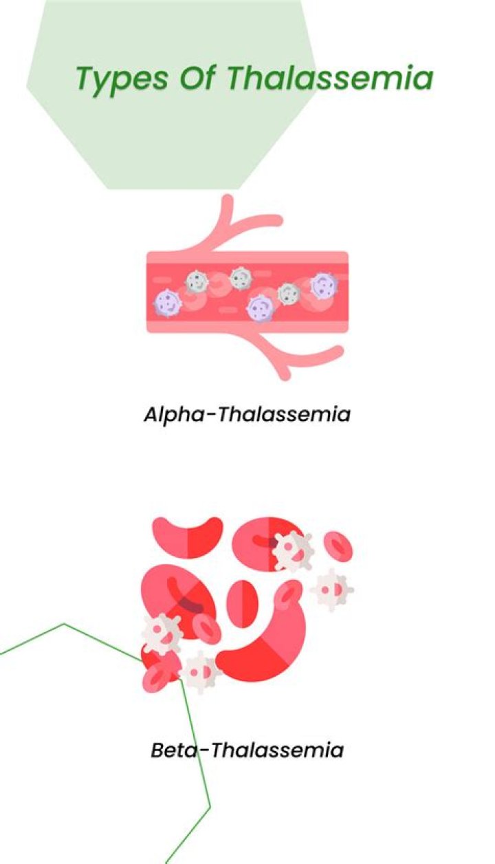 What are the 4 types of thalassemia?