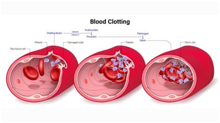 What are the pathways of blood clotting system?