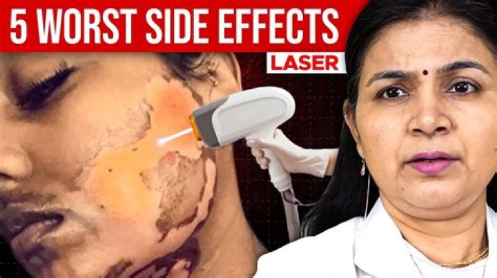 What are the side effects of lipo laser?