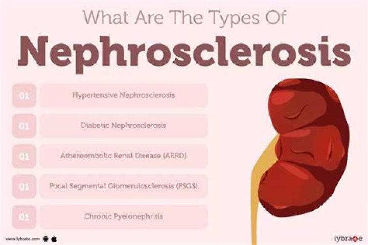 What are the signs and symptoms of nephrosclerosis?