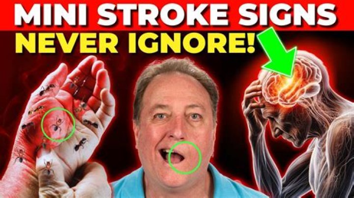 What are the signs of a mini stroke in a man?