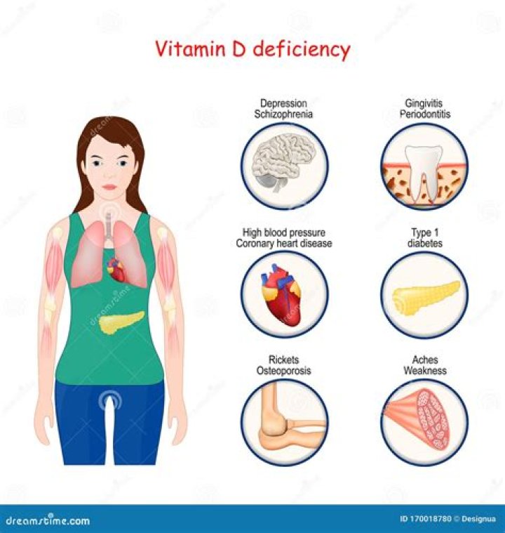 What are the symptoms of vitamin D deficiency in babies?