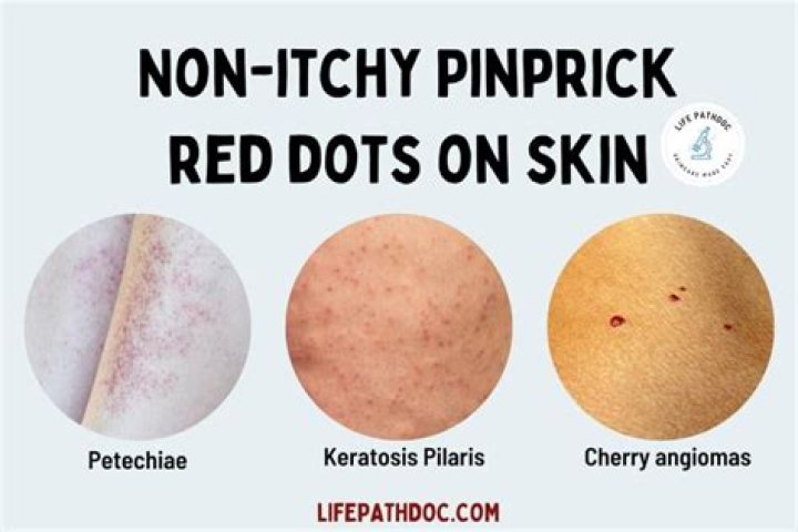 What are tiny red pin pricks on skin?
