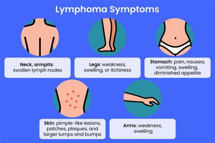 What can lymphoma be mistaken for?