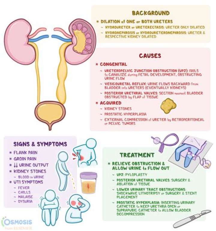 What can urinary obstruction cause?