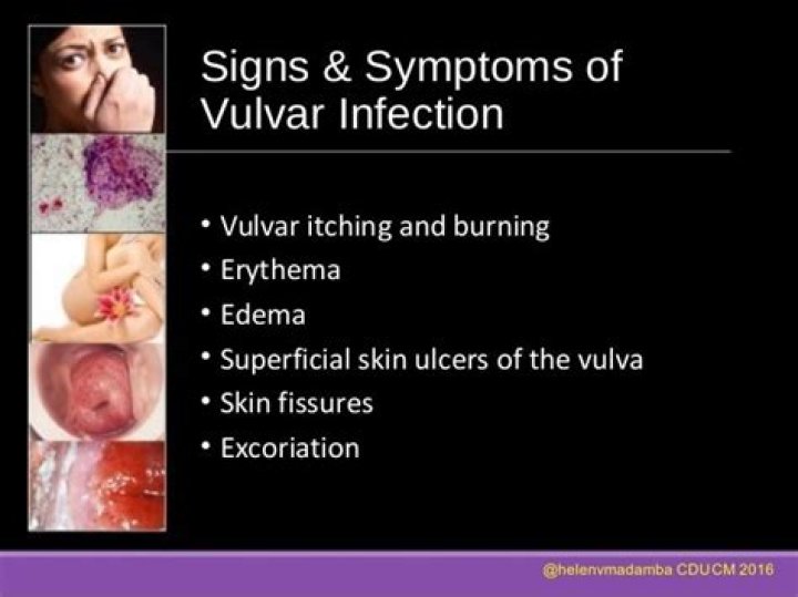 What causes chronic inflammation of the vulva?