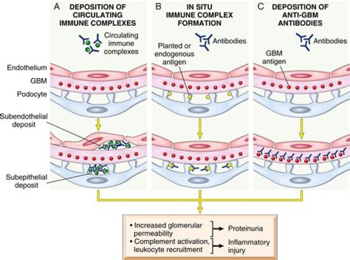 What causes Hyalinosis?