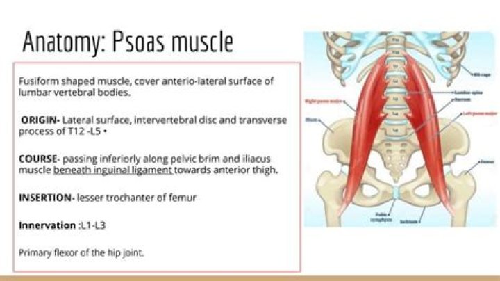 What causes psoas abscess?