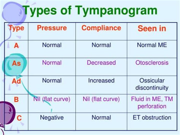 What does a Type C Tympanogram mean?