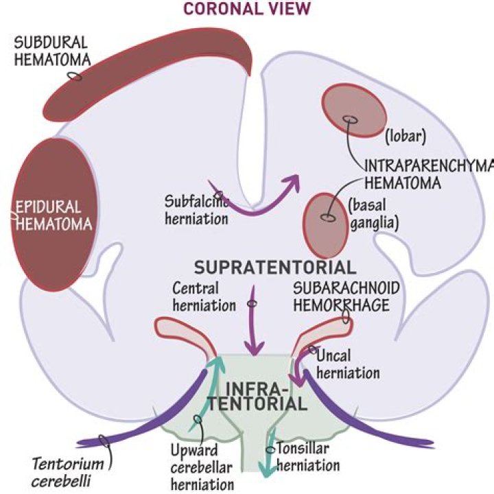 What does cerebral lateralization refer to
