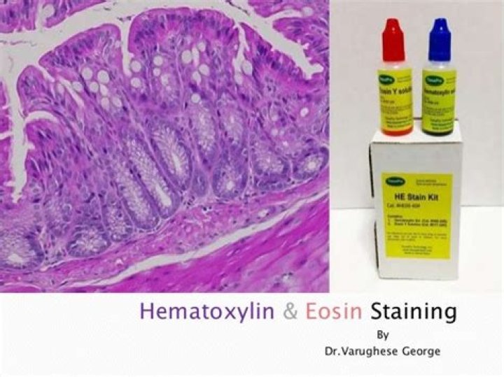 What does hematoxylin and eosin stain
