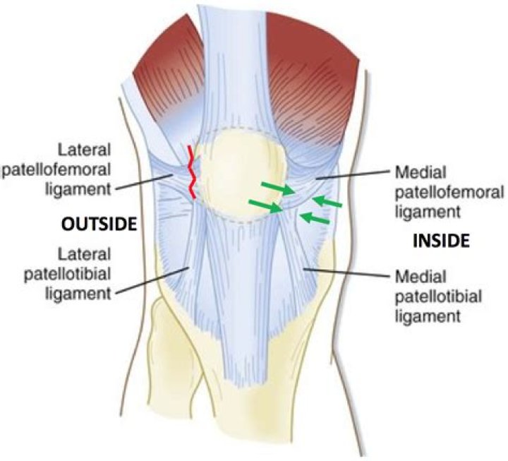 What does the patella do?