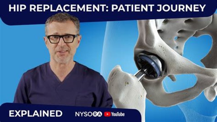 What happens if you wait too long to have a hip replacement?