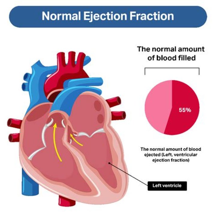 What is a bad ejection fraction for gallbladder