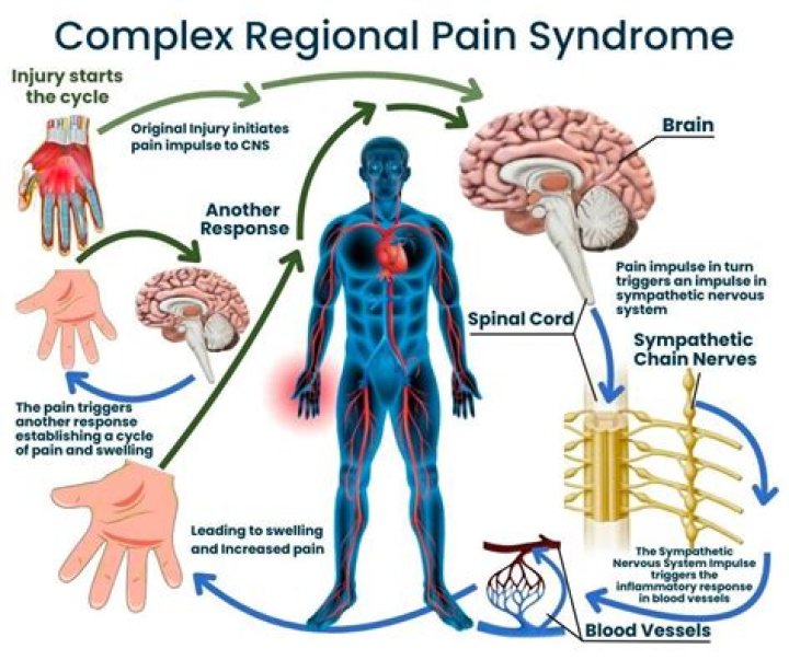 WHAT IS A GO complex?