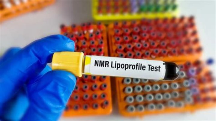 What is a NMR lipoprotein profile?